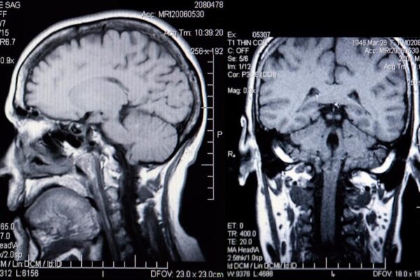 Режим активации сознания Режим активации сознания